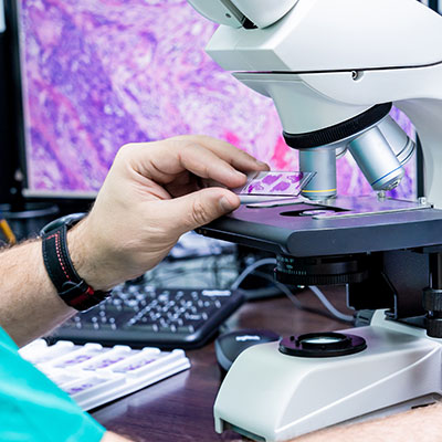 Sentinel Lymph Node Biopsy